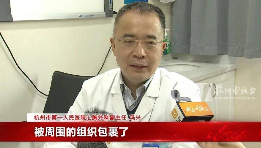 17岁小伙参军体检发现胸腔内有根5cm缝衣针，父母回忆或是1岁时扎入，取出时已锈迹斑斑