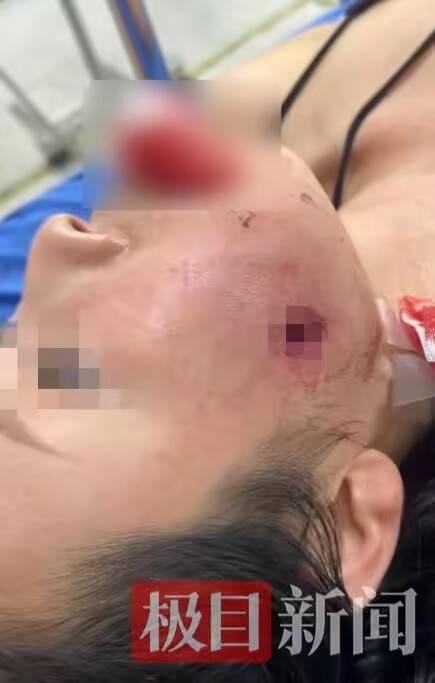 我总领馆就“中国游客在泰国脸部中弹”发布提醒，伤者女儿：母亲住院只能吃流食，伤口恢复还需3个月，将起诉索赔